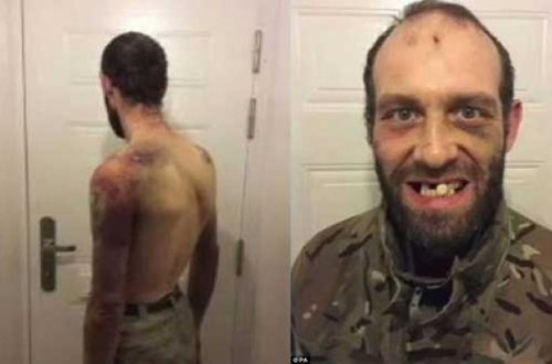 QADIN KIŞININ CINSIYYƏT ORQANINI KƏSDI VƏ... - ÖLÜMÜNDƏN ÖNCƏ ÇƏKILƏN FOTOLAR