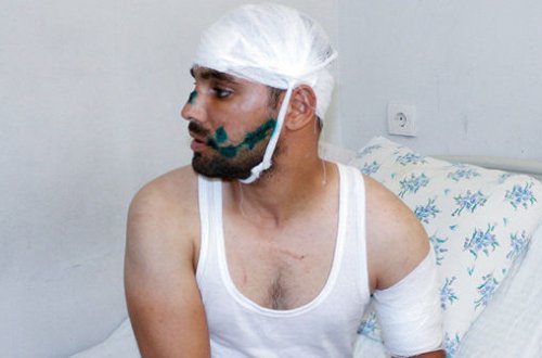 BAKIDA GECƏ QADIN MÜŞTƏRISININ EVINƏ GEDƏN TAKSI SÜRÜCÜSÜNÜN AĞZINI CIRDILAR – FOTO