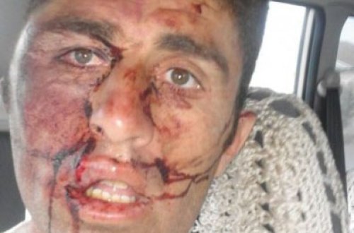 Kərəm Həsənovun əmisi oğlu vətəndaşı qanına qəltan edib! – ŞİKAYƏT