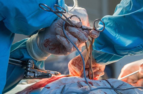 Kredit ödəməmək üçün plastik əməliyyat etdirdi