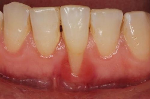 Qadınların hamilə qala bilməməsinin SƏBƏBİ ÜZƏ ÇIXDI