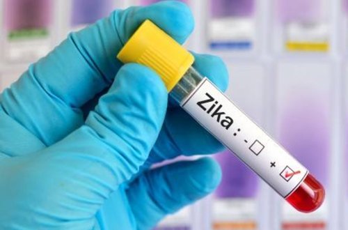 ABŞ-da həyəcan təbili — Zika virusu tapıldı