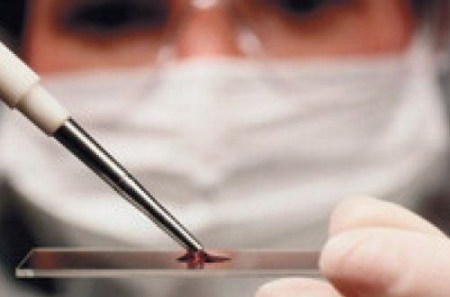 Tovuzda ana və bətindəki körpə keysəriyyə əməliyyat zamanı ölüb