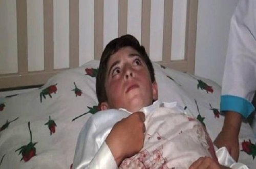 Ermənilərin yaraladığı 13 yaşlı Raminin vəziyyəti necədir? - Açıqlama