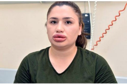 Azərbaycanda təhsil alan saxta həkim Adana həbsxanasından qaçıb — ŞOK HADİSƏ