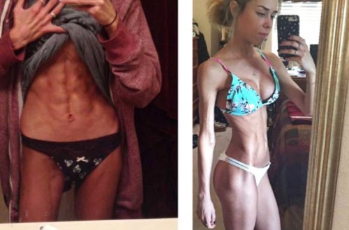 Xəstəlikdən sağalan gənc qız hamını kövrəltdi - FOTOLAR