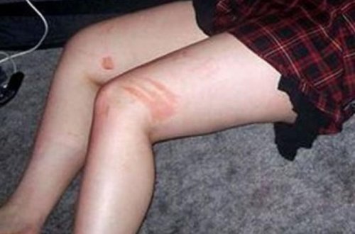 Sinif yoldaşları tərəfindən zorlanan məktəbli qız: “Mən 3 il idi zorlanırdım, amma...”