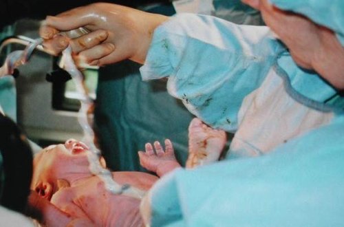 Gəncədə körpə doğuşdan sonra ölüb