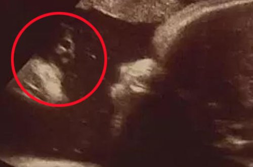 Hamilə qadın müayinə zamanı qorxuya düşdü: bətnində qəribə varlıq göründü - FOTO