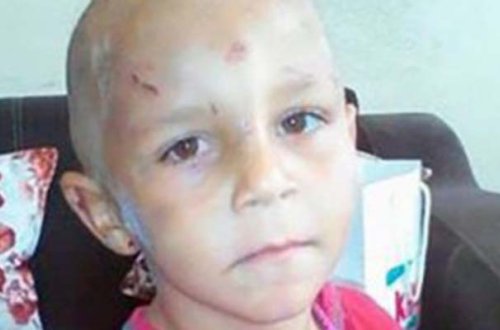 Valideynləri 4 yaşlı uşağı döyüb küçəyə atıblar? - Foto