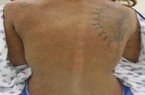 Meşədə 25 yaşlı qız tapdı, DƏHŞƏTƏ GƏLDİ: Çılpaq, bədəni dişlək-dişlək - FOTOLAR/VİDEO