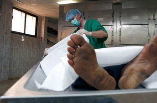 Sağalıb çıxdığı xəstəxanın həyətində ölü tapıldı - VİDEO