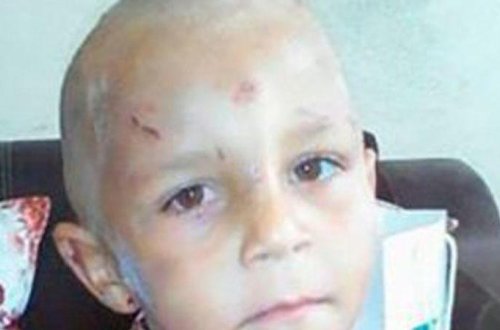 Bakıda döyülüb küçəyə atılan 4 yaşlı uşaqla bağlı DƏHŞƏTLİ FAKTLAR (YENİLƏNDİ)