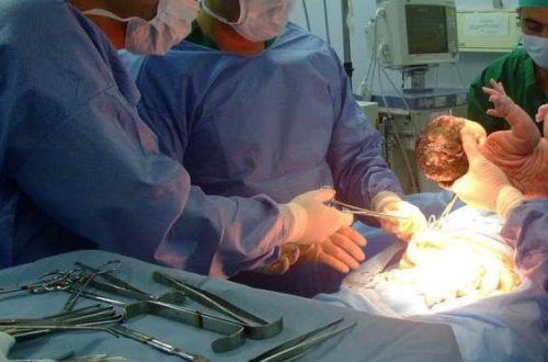 Nazirlik qeysəriyyə əməliyyatlarının artmasının səbəbini açıqladı