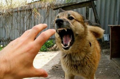 Tovuzda 5 yaşlı oğlanı it dişlədi