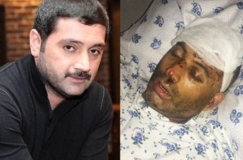 İzzət Bağırova görə döyülən şəxsin görüntüləri yayıldı: Vəziyyəti ağırdır - FOTO/VİDEO