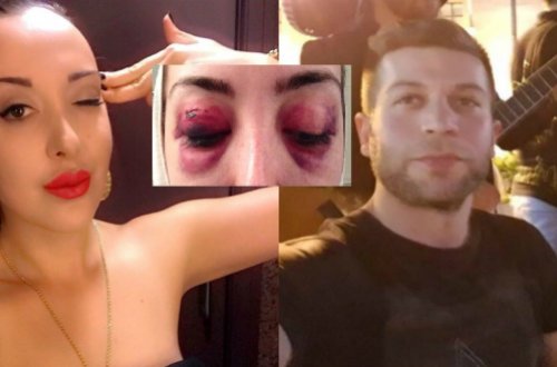 Azərbaycanda kişi keçmiş həyat yoldaşını ölümcül şəkildə döydü (FOTO)