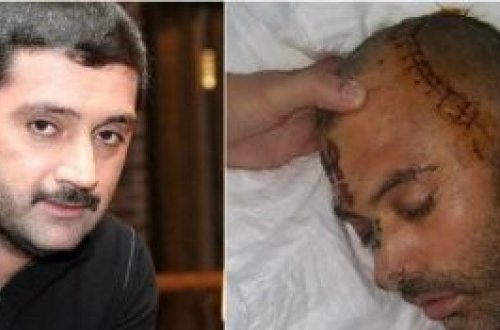 İzzətin xanımı toyda döyülənlərdən ÜZR İSTƏDİ: ÖZÜ DƏ PUL TƏKLİF ELƏYİBMİŞ... (+18 FOTOLAR)