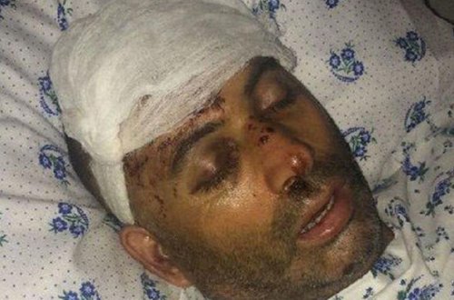 İzzət Bağırovun restoranda döydürdüyü şəxsin fotoları