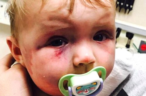 Ana qızını qaşıqla döydü, eyvandan atmaq istədi - FOTO