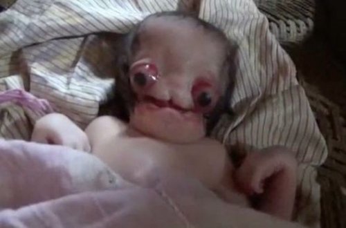 Hindistanda mutant uşaq dünyaya gəlib – VİDEO