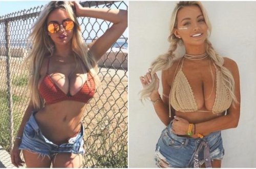 Sinəsinin böyüklüyündən gileyləndi - fotolar