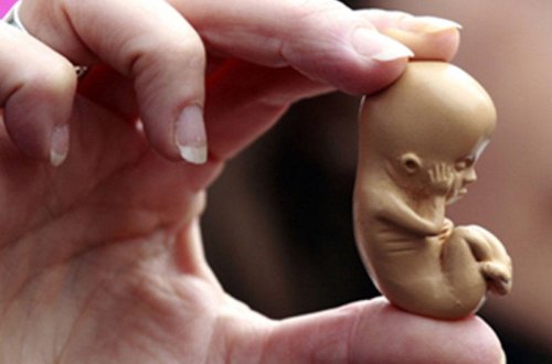 Qanunsuz abort edənləri 2 illik həbs cəzası gözləyir