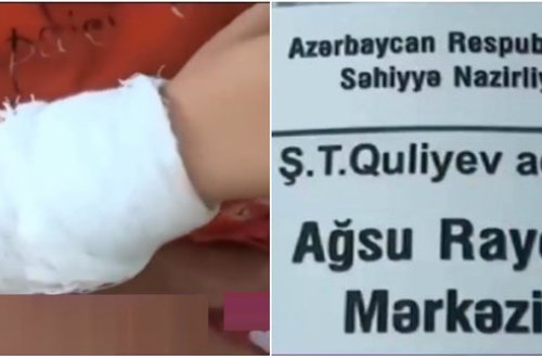 Ağsuda RƏZİLLİK: Azyaşlı uşağa YALANDAN sınıq diaqnozu QOYULDU - VİDEO