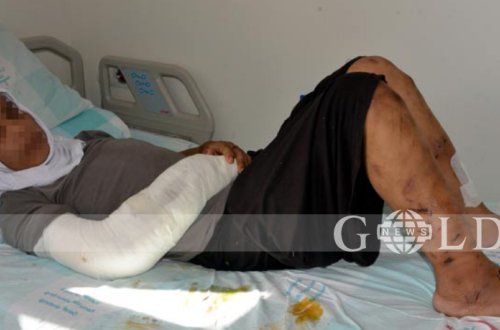 Arvadına 15 gün işgəncə verdi - Dəmirlə döydü, bədənində siqaret söndürdü, üstünə qaynar yağ tökdü