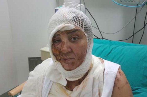 Türk kişidən azərbaycanlı qadına qarşı vəhşilik - Zorlamaq istədi, alınmadı... - VİDEO 