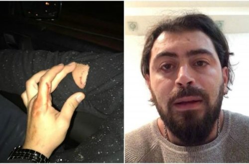 Küçə itləri azərbaycanlı reperə hücum etdi – FOTO