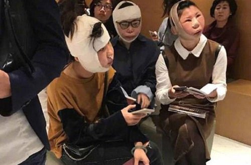 Plastik cərrahiyyə qurbanları - aeroportda gözlədilər - FOTO