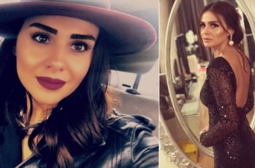 Əməliyyatla tanınmaz hala düşən Günel Zeynalovanın İbrahim Tatlısəslə münasibətləri korlandı – FOTO