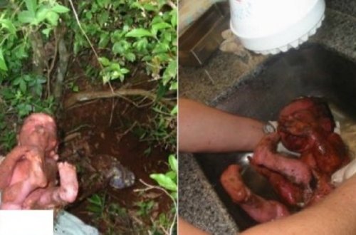 VƏHŞİLİK! Yeni doğulmuş körpəni 14 yerindən bıçaqlayıb diri-diri basdırdılar (+18 FOTOLAR)