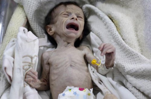 Suriya xəstəxanasında çəkilən ürəkağırdan FOTO