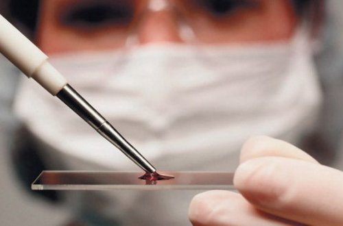 Həkim pasiyentləri gizlicə öz sperması ilə mayalandırdı - Ölkə qalmaqalla silkələndi