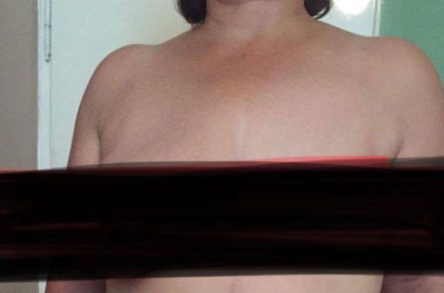 Azərbaycanda təksinəli xanım uğurlu əməliyyatdan sonra cütsinəli oldu — FOTOLAR