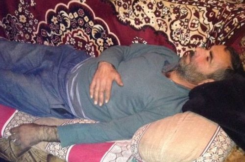 Tərtərdə zəlzələ nəticəsində bir nəfər xəsarət alıb - FOTO