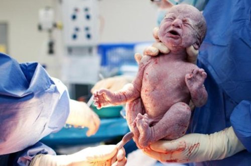 Qadınlar təbii doğuşdan niyə qaçır?