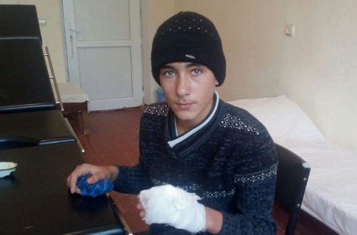 Qobustanda çaqqallar yeniyetmə oğlana hücum etdi – FOTO