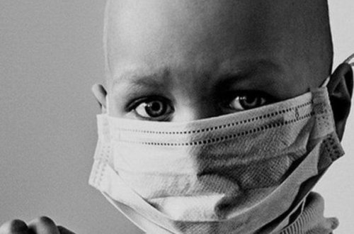 Xərçəngə tutulan uşaqların sayı artıb