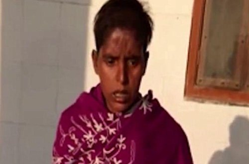 Dəhşətli kadrlar: qadının başından qurdlar çıxarıldı - VİDEO