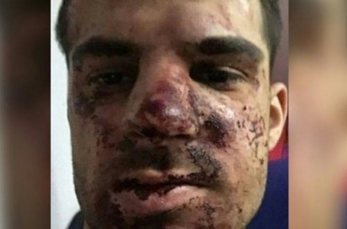 Futbolçunu ölümcül hala saldılar - Foto