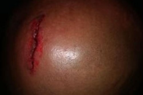 Hakimi qanına qəltan etdilər - FOTO