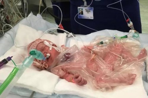 Uşağın ürəyinin yarısı çöldə doğuldu – Ürəyi zəif olanlar baxmasın - FOTO/VİDEO