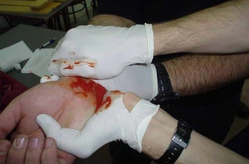 SON DƏQİQƏ: Göyçayda Məktəb direktoru intihara əl atdı - İCRA BAŞÇISINA GÖRƏ