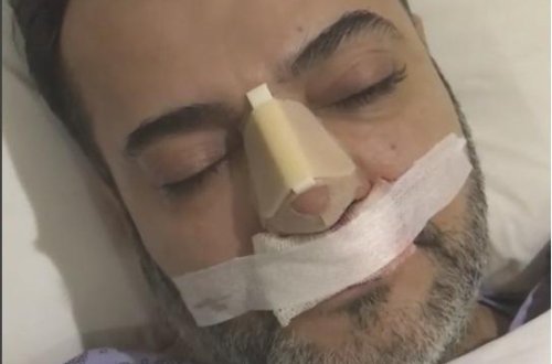 Çoşqun 7 saat davam edən əməliyyatdan sonra ilk dəfə - video