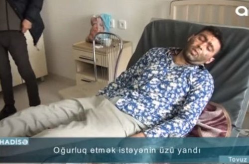 Ev sahibi oğrunun üzünü yandırdı – FOTO + VİDEO