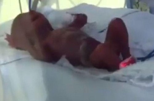 Bakıda çəkisi 370 qram olan uşaq doğuldu - Ailəsi istəmədi - VİDEO