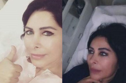 Ərdoğan xərçəng xəstəsi olan müğənninin xərclərini üzərinə götürdü